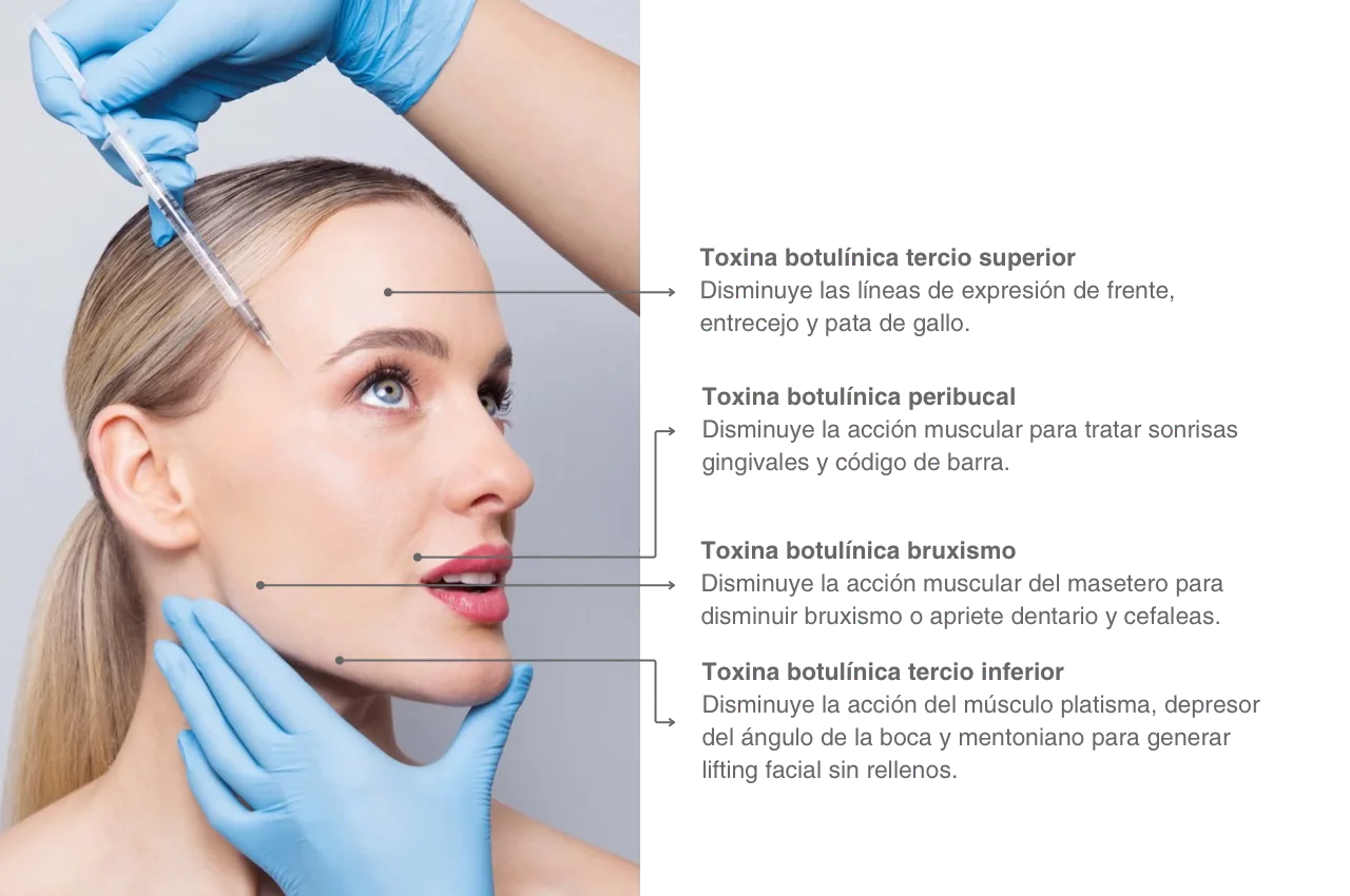 Caso estética 1