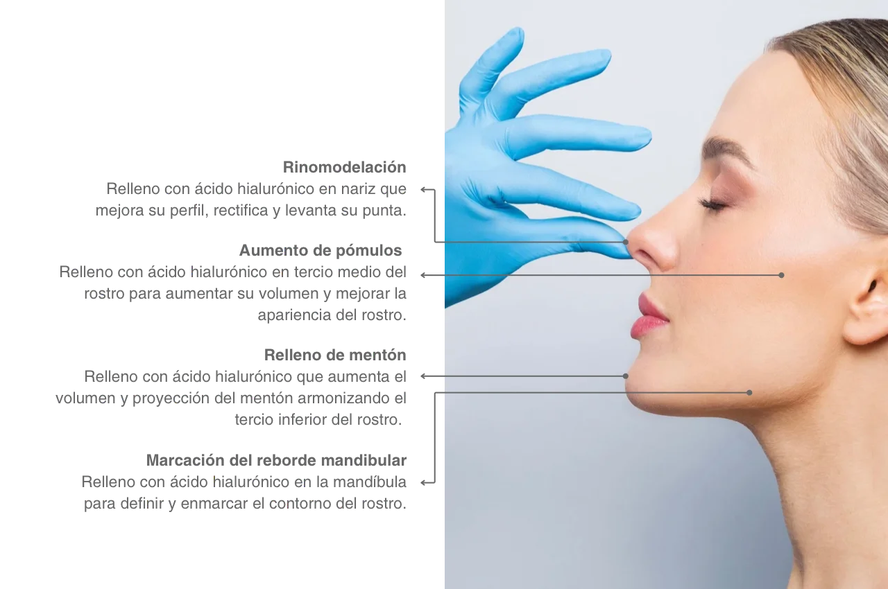 Caso estética 2