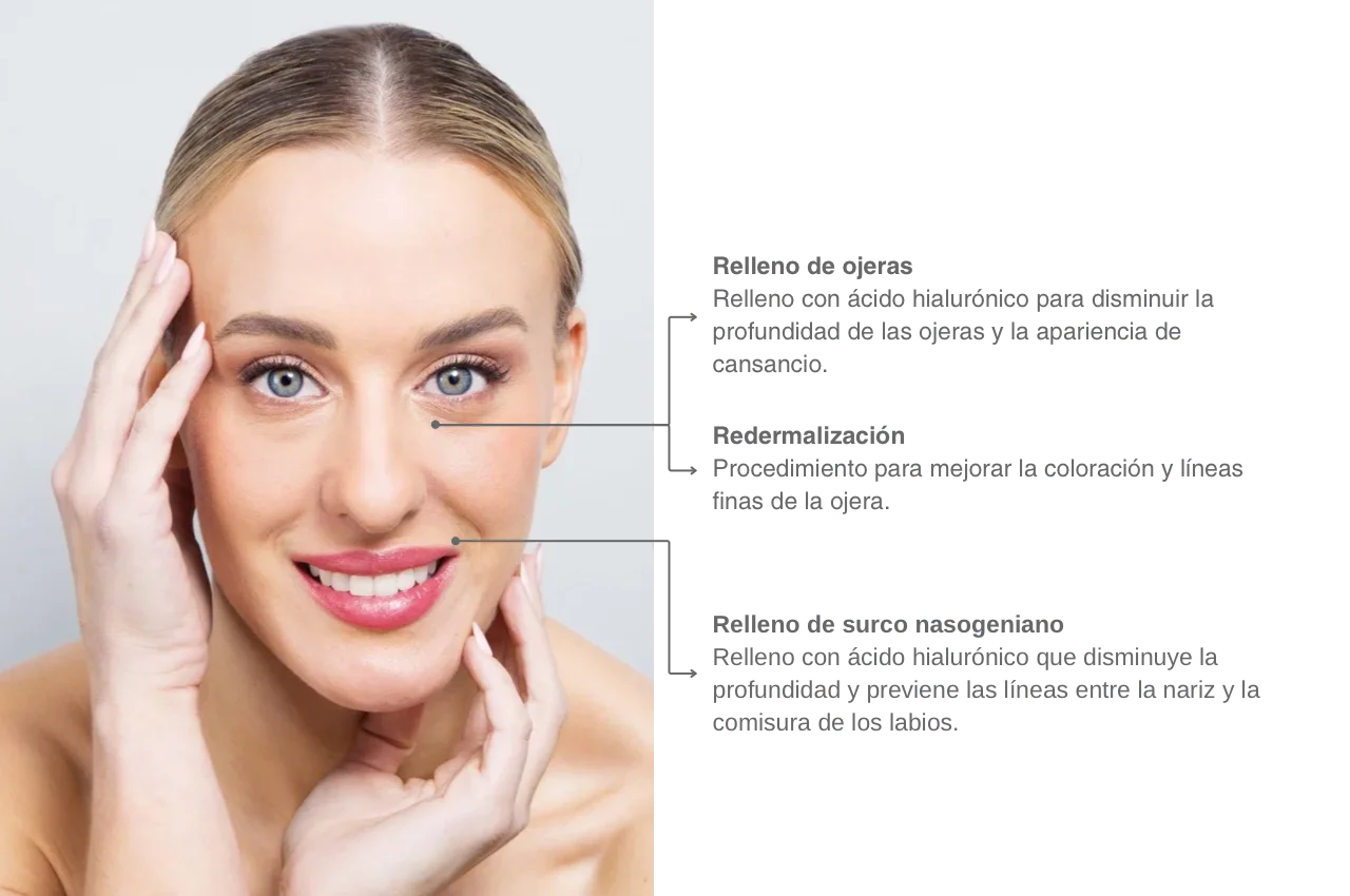 Caso estética 3