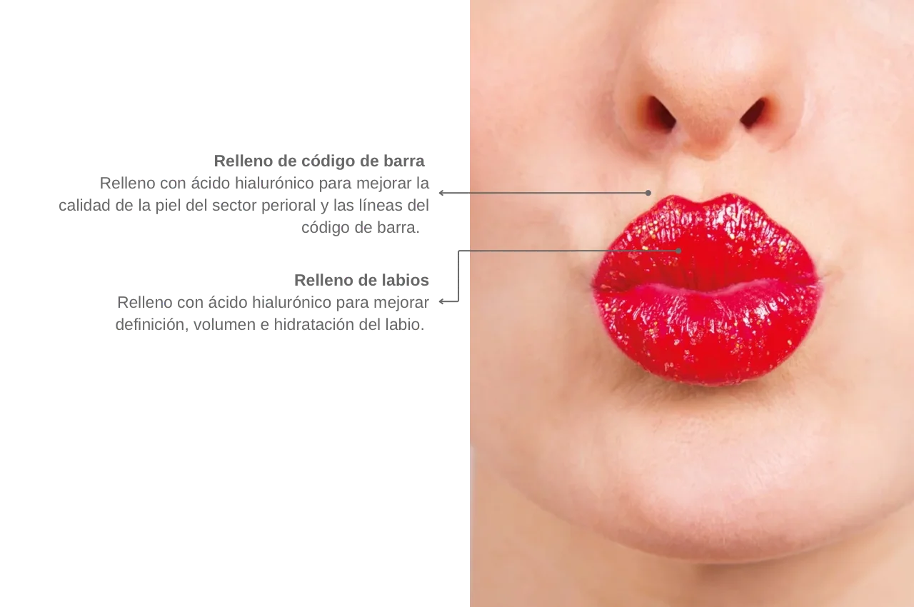 Caso estética 4
