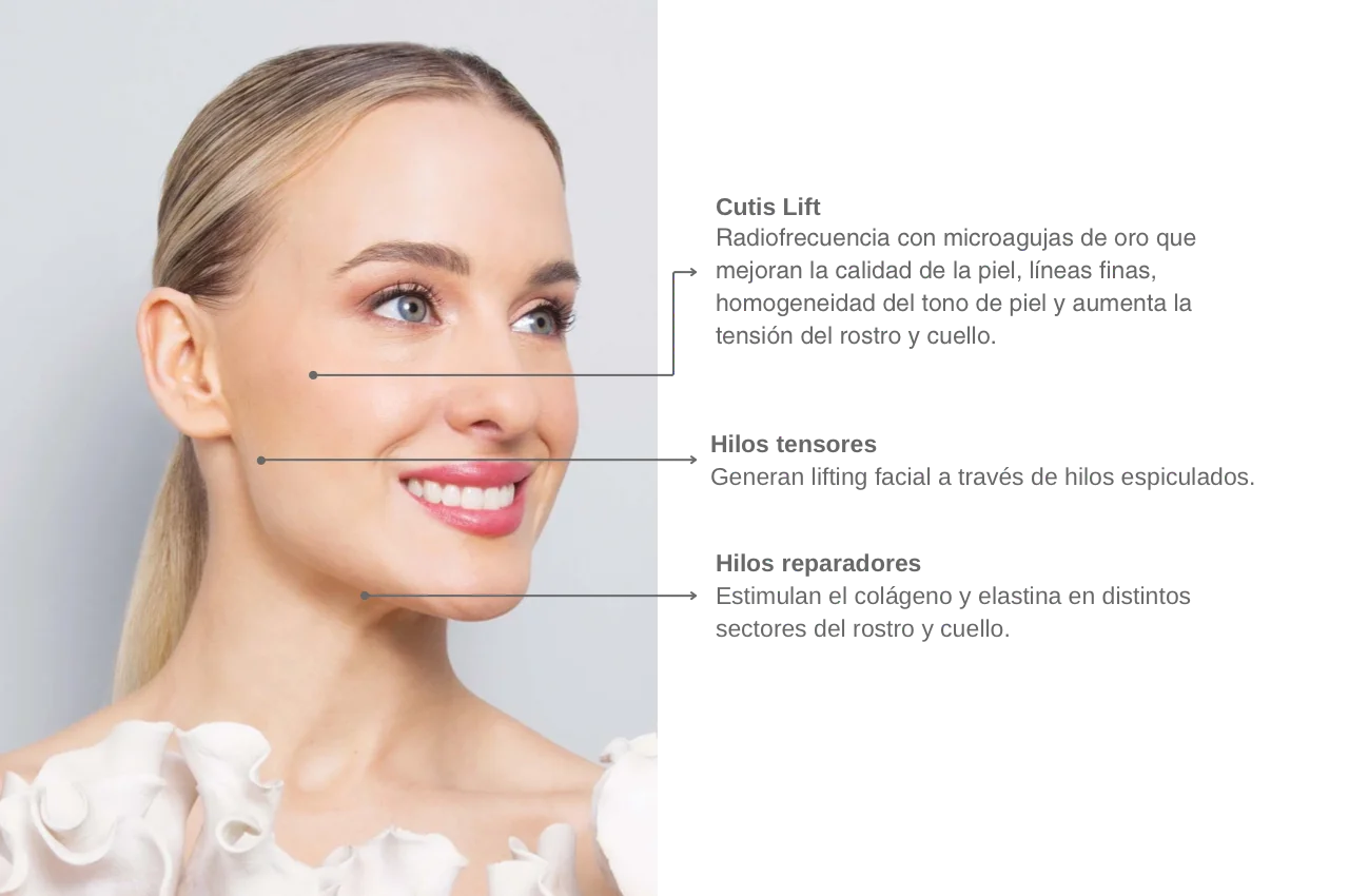 Caso estética 5
