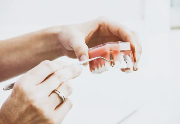 Implantología y periodoncia imagen