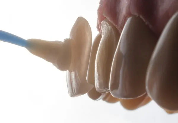 Rehabilitación oral imagen